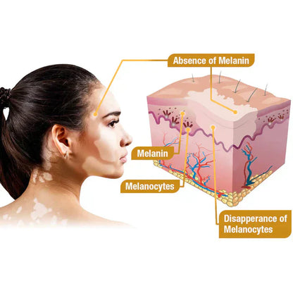 Revitalizing Bee Venom Cream – Natural Skin Restoration & Vitality (Buy 1 Get 1 Free🔥)